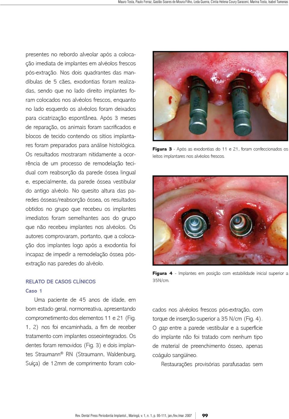 Nos dois quadrantes das mandíbulas de 5 cães, exodontias foram realizadas, sendo que no lado direito implantes foram colocados nos alvéolos frescos, enquanto no lado esquerdo os alvéolos foram