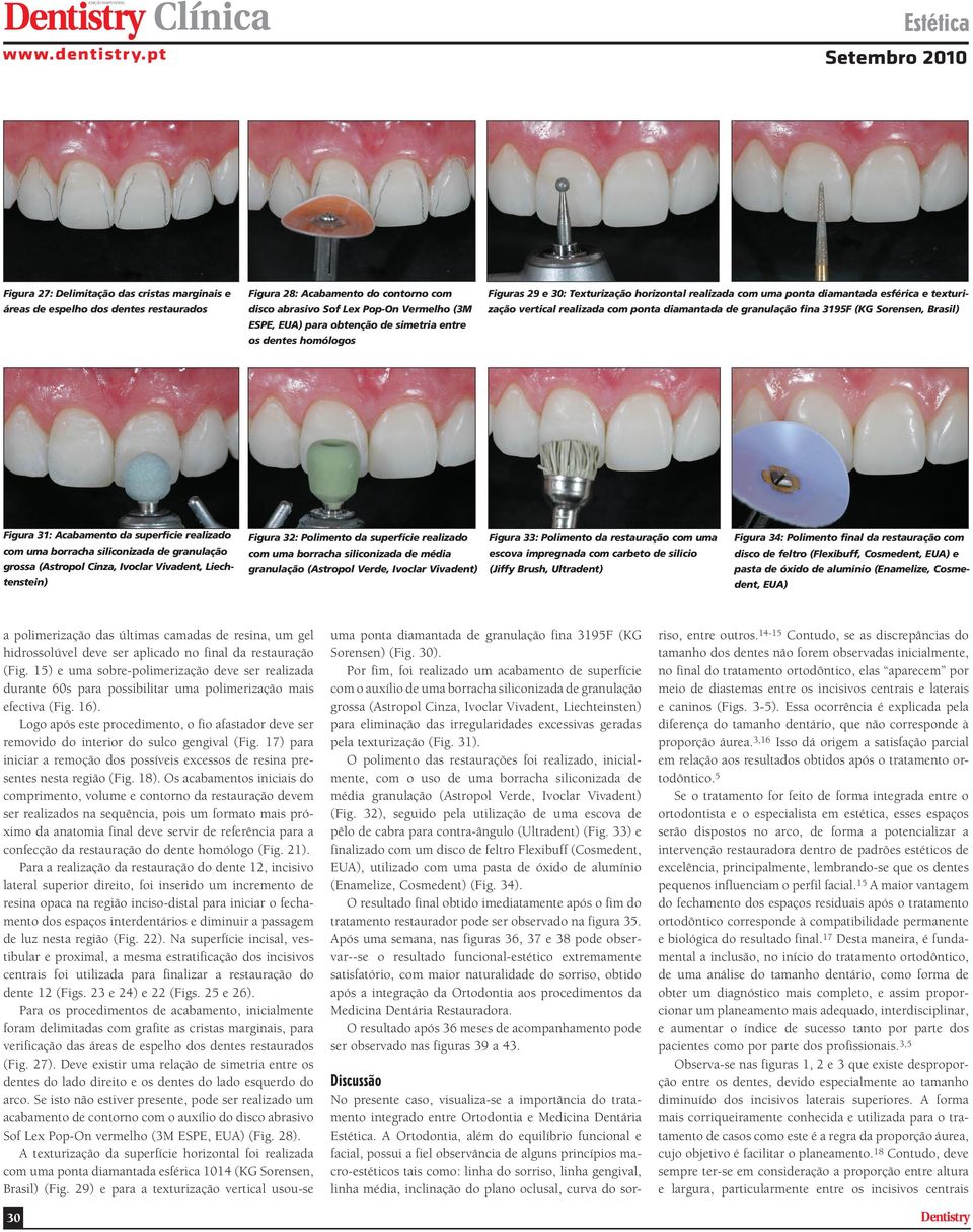 simetria entre os dentes homólogos Figura 31: Acabamento da superfície realizado Figura 32: Polimento da superfície realizado Figura 33: Polimento da restauração com uma Figura 34: Polimento final da