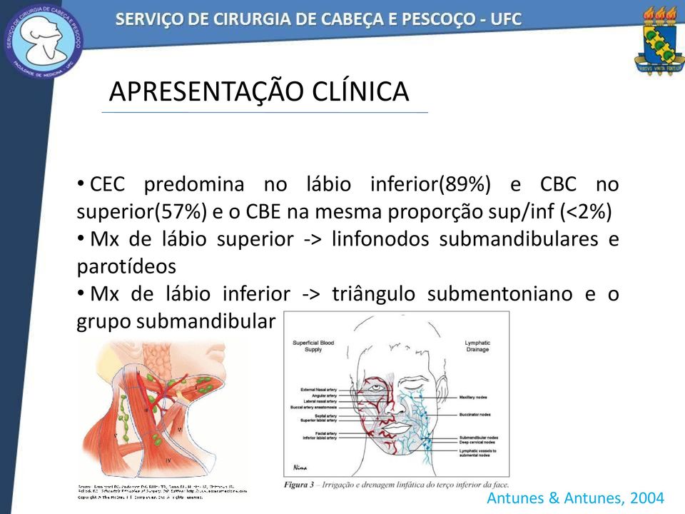 superior -> linfonodos submandibulares e parotídeos Mx de lábio