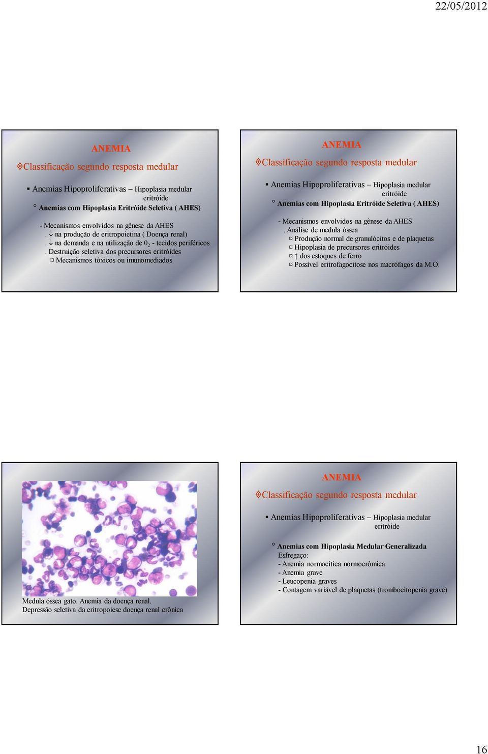 Destruição seletiva dos precursores eritróides Mecanismos tóxicos ou imunomediados Anemias Hipoproliferativas Hipoplasia medular eritróide Anemias com Hipoplasia Eritróide Seletiva ( AHES) -