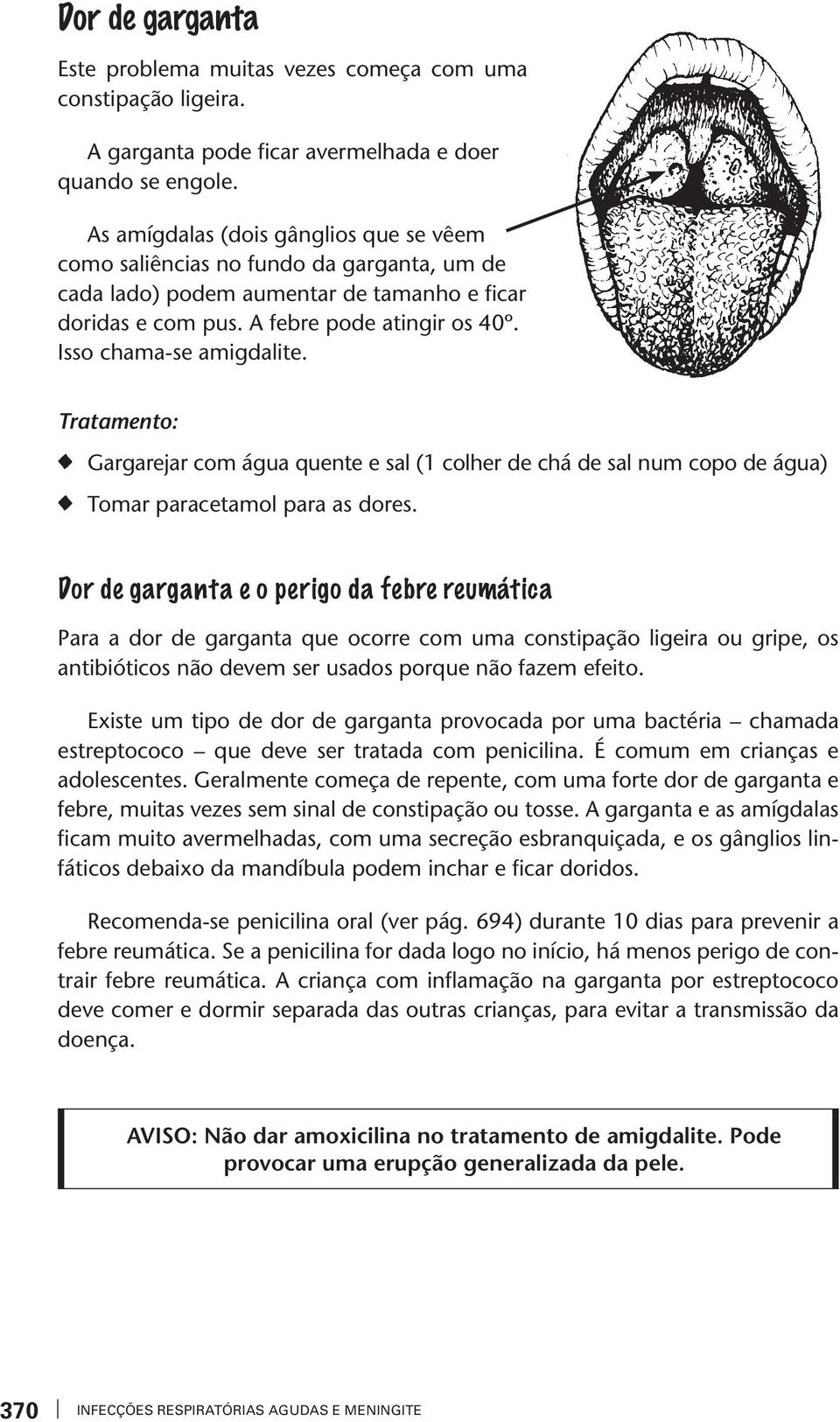 Traameno: Gargarejar com água quene e sal (1 colher de chá de sal num copo de água) Tomar paraceamol para as dores.