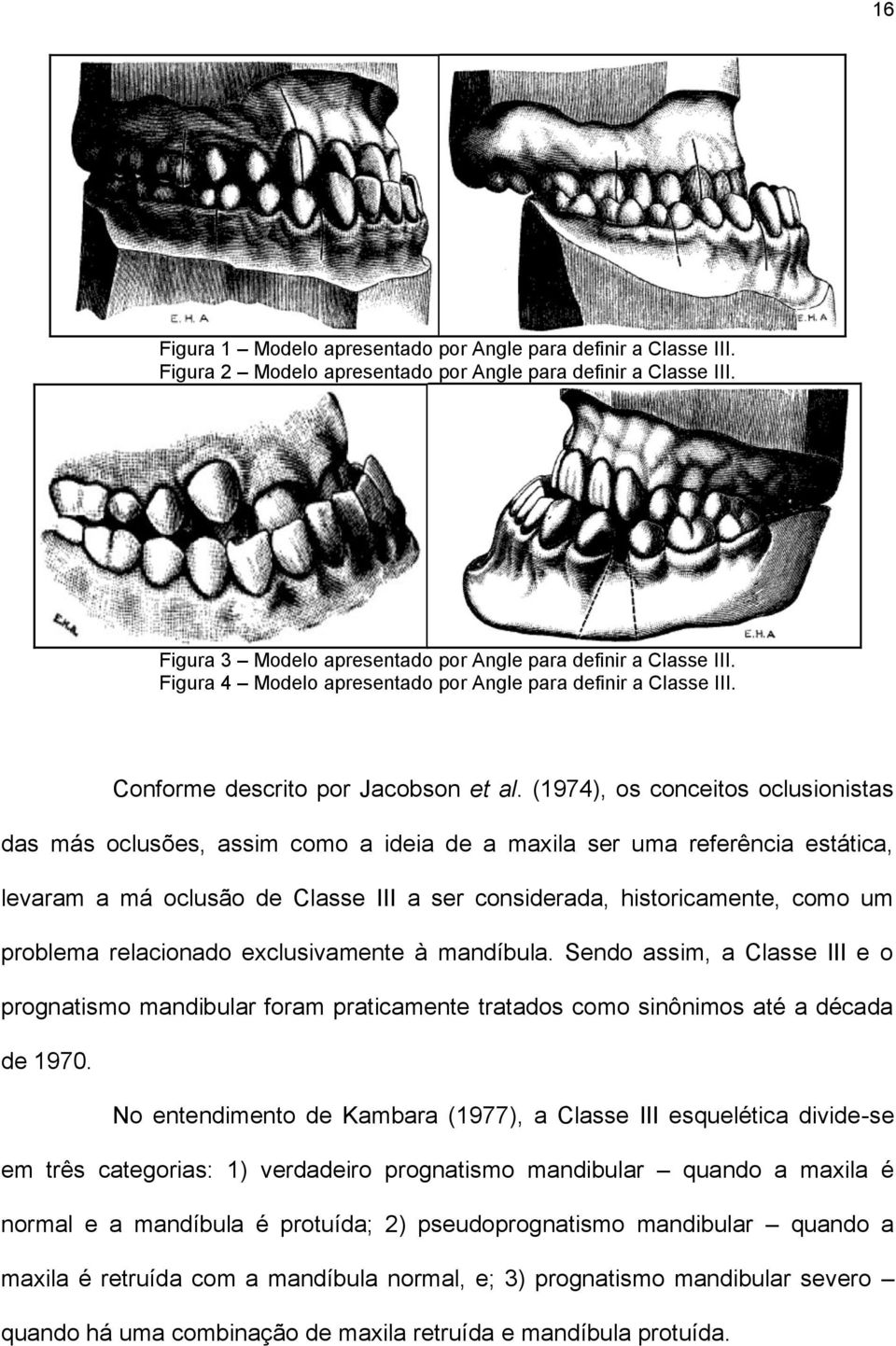 (1974), os conceitos oclusionistas das más oclusões, assim como a ideia de a maxila ser uma referência estática, levaram a má oclusão de Classe III a ser considerada, historicamente, como um problema