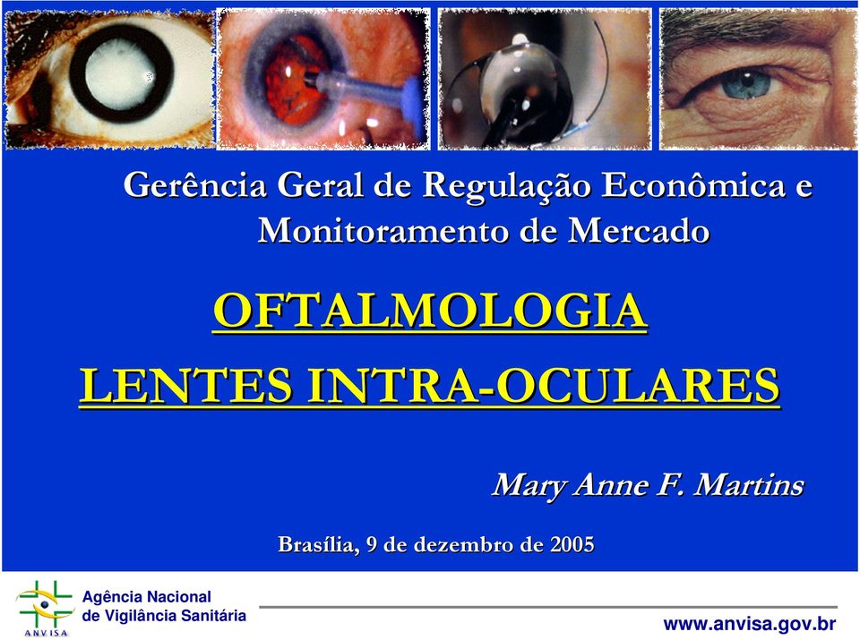 OFTALMOLOGIA LENTES INTRA-OCULARES