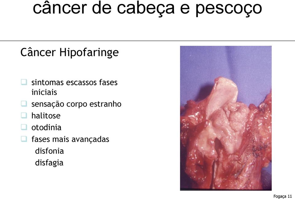 corpo estranho halitose otodinia