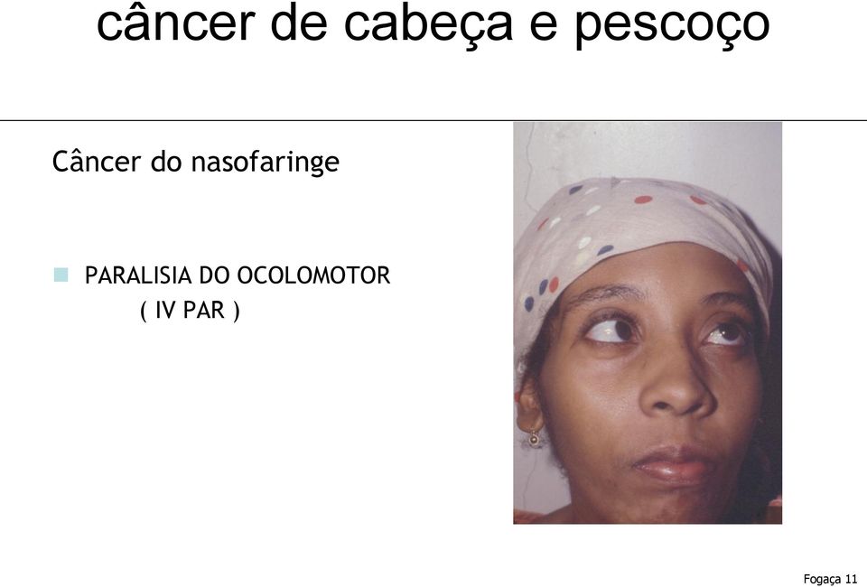 PARALISIA DO