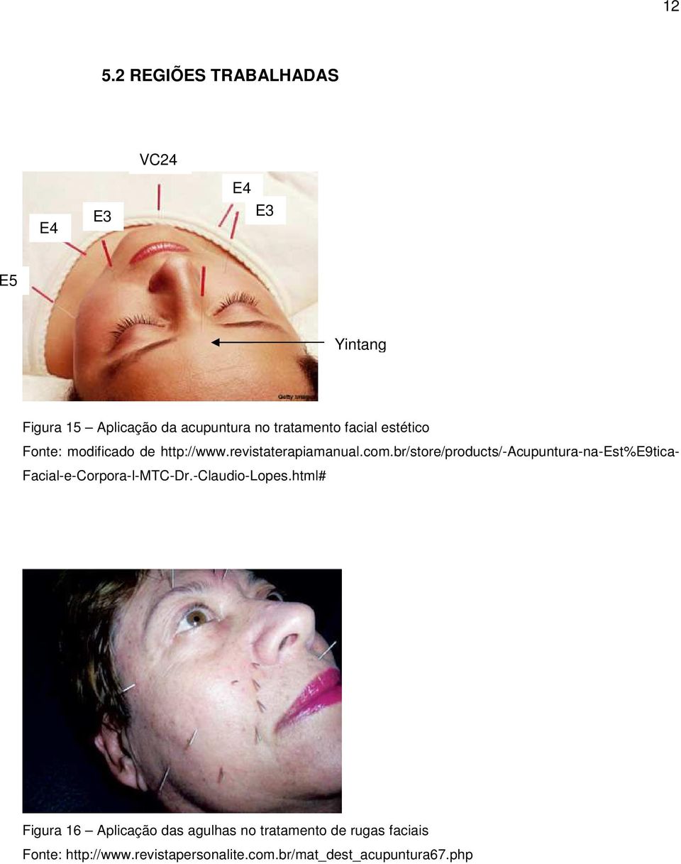 br/store/products/-acupuntura-na-est%e9tica- Facial-e-Corpora-l-MTC-Dr.-Claudio-Lopes.