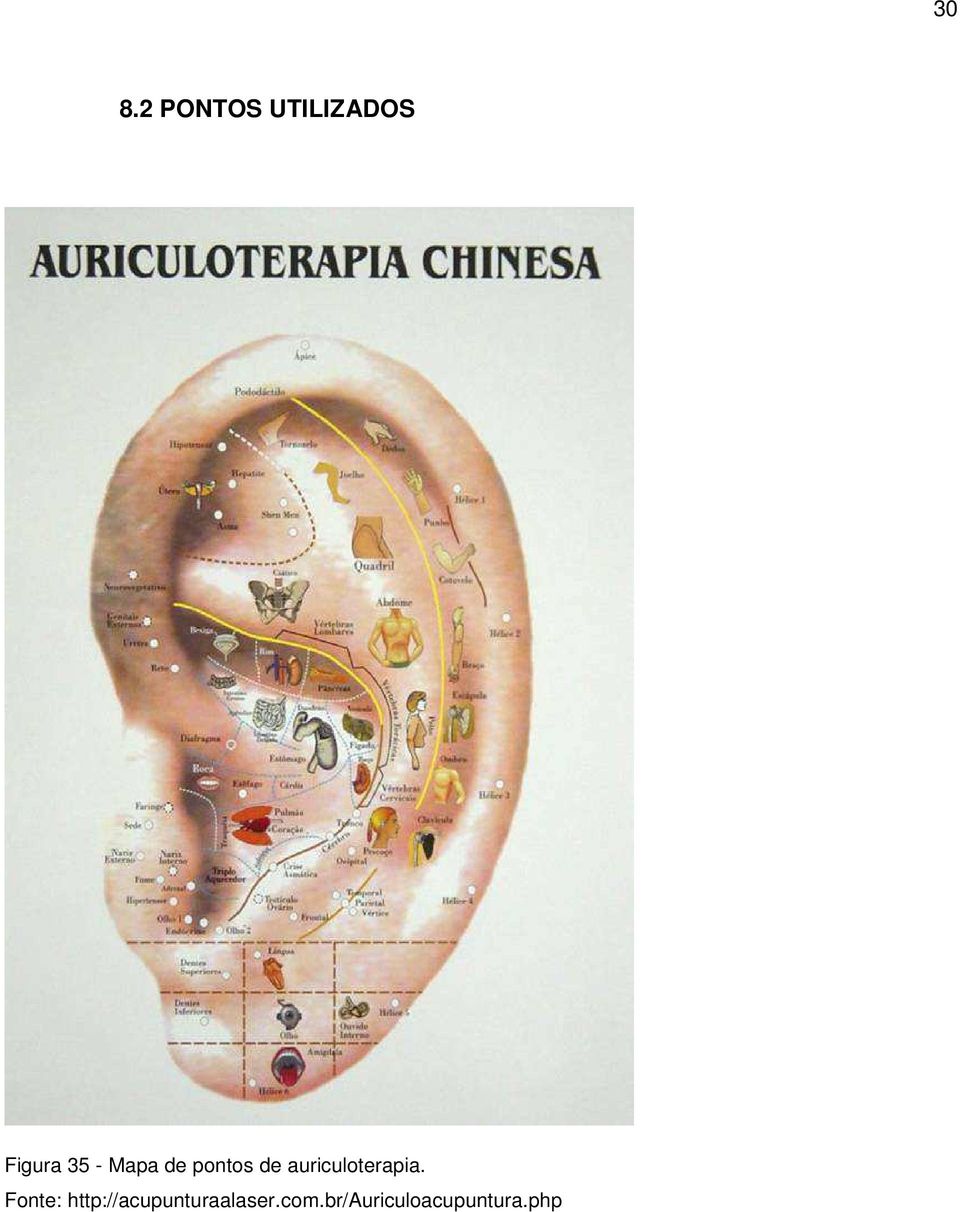auriculoterapia.