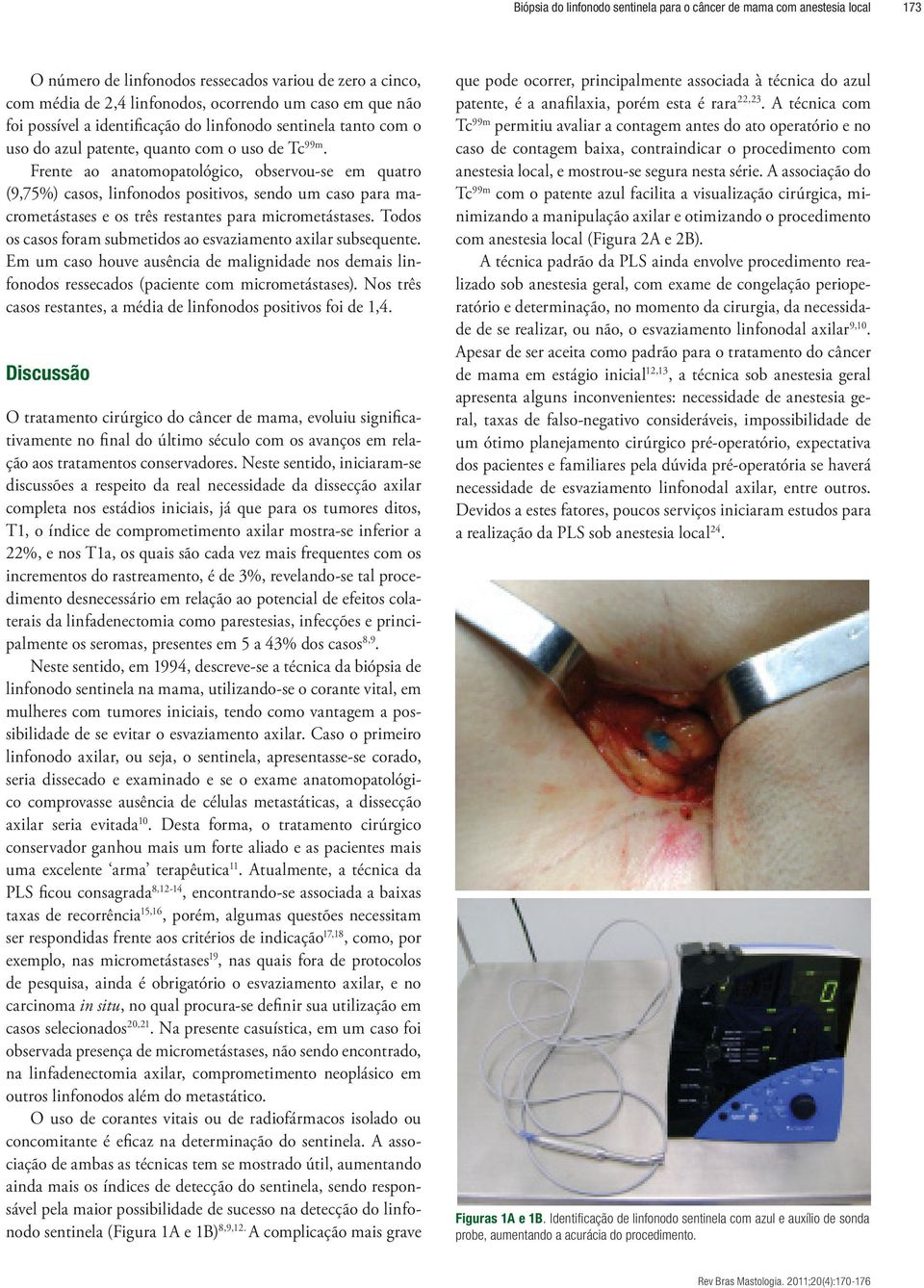 Frente ao anatomopatológico, observou-se em quatro (9,75%) casos, linfonodos positivos, sendo um caso para macrometástases e os três restantes para micrometástases.