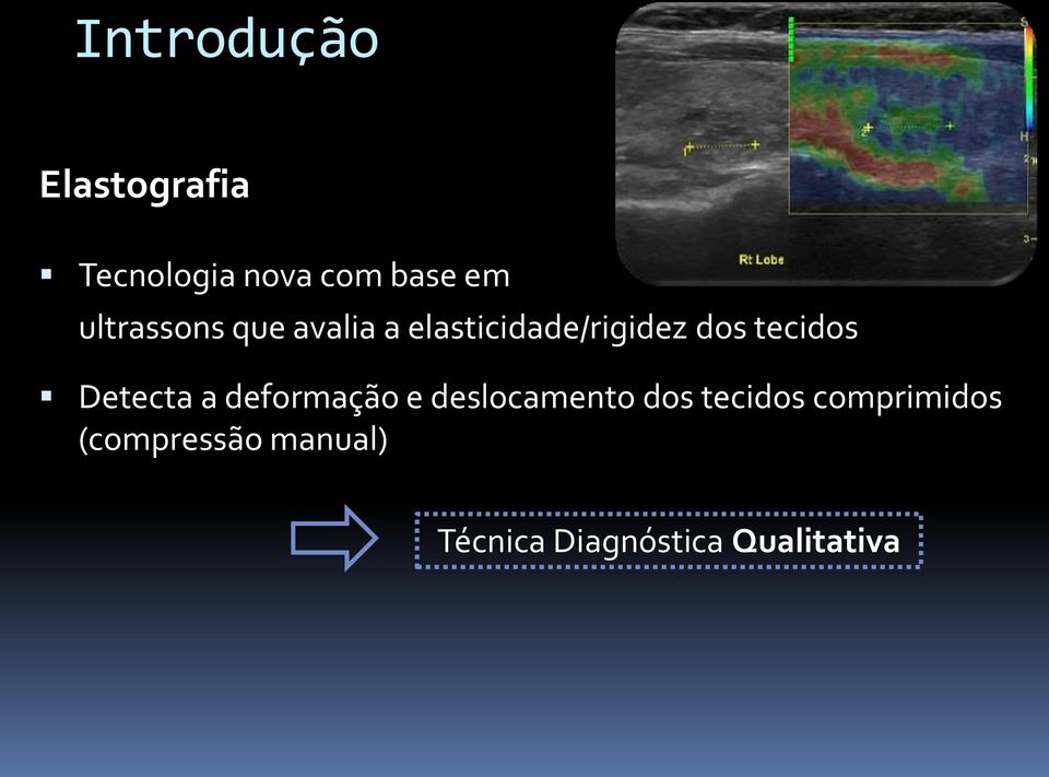 tecidos Detecta a deformação e deslocamento dos