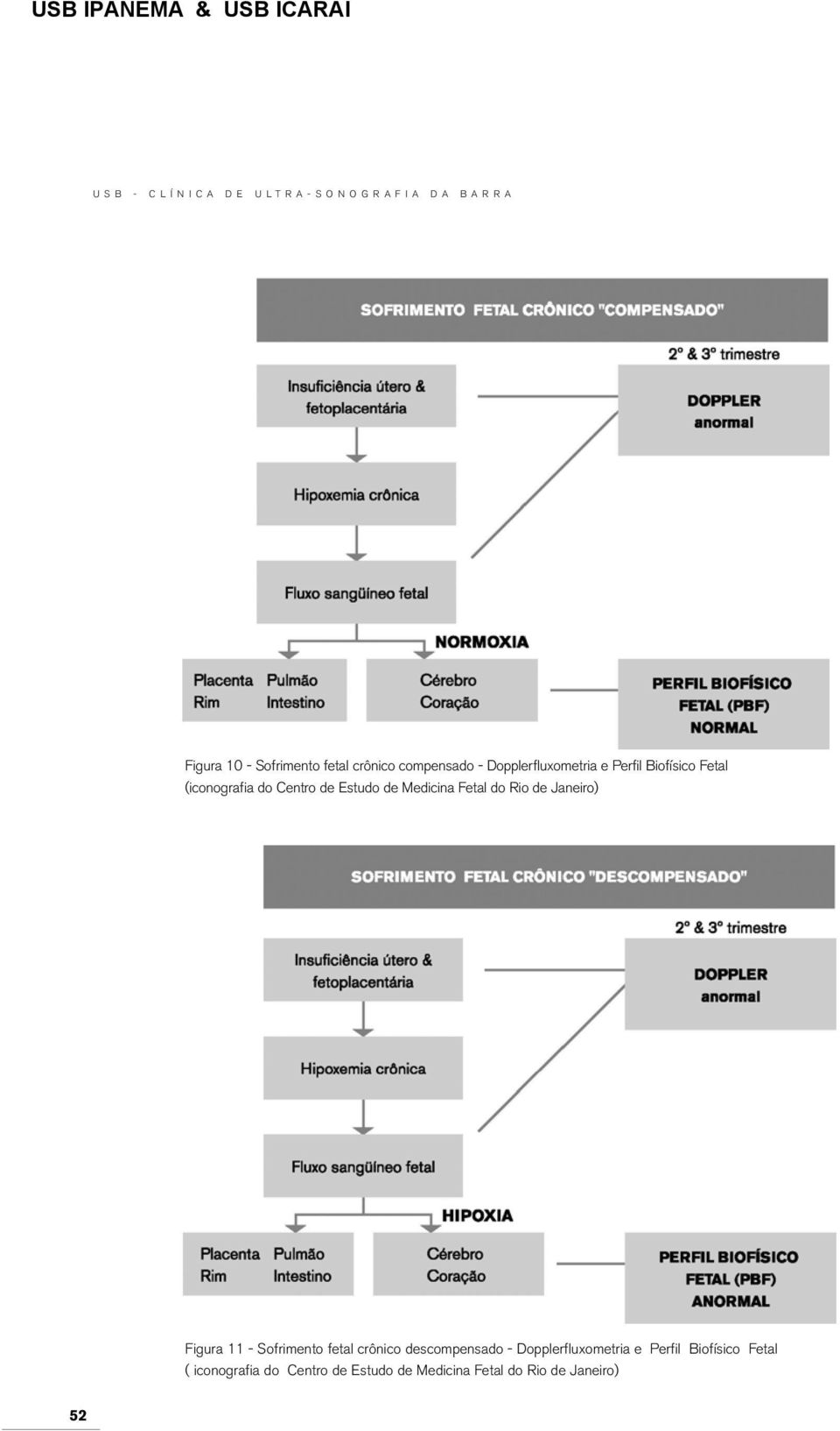 Janeiro) Figura 11 - Sofrimento fetal crônico descompensado - Dopplerfluxometria e