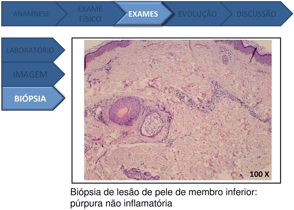 X Biópsia de lesão de pele de