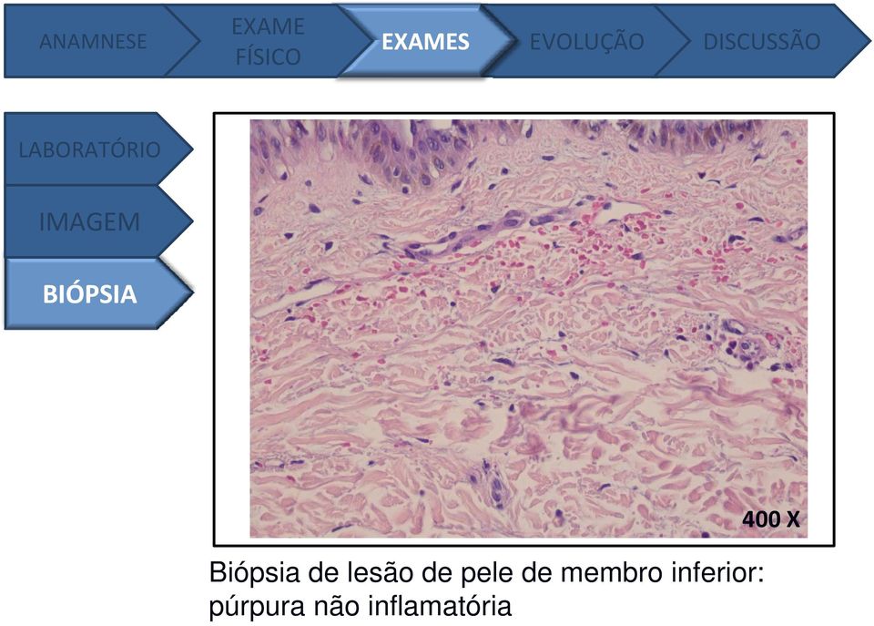 X Biópsia de lesão de pele de