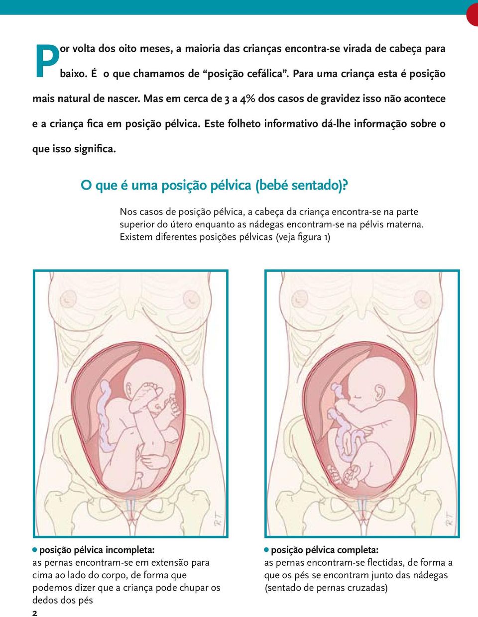 O que é uma posição pélvica (bebé sentado)? Nos casos de posição pélvica, a cabeça da criança encontra-se na parte superior do útero enquanto as nádegas encontram-se na pélvis materna.