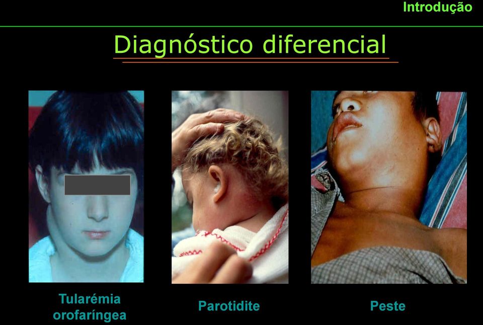 diferencial