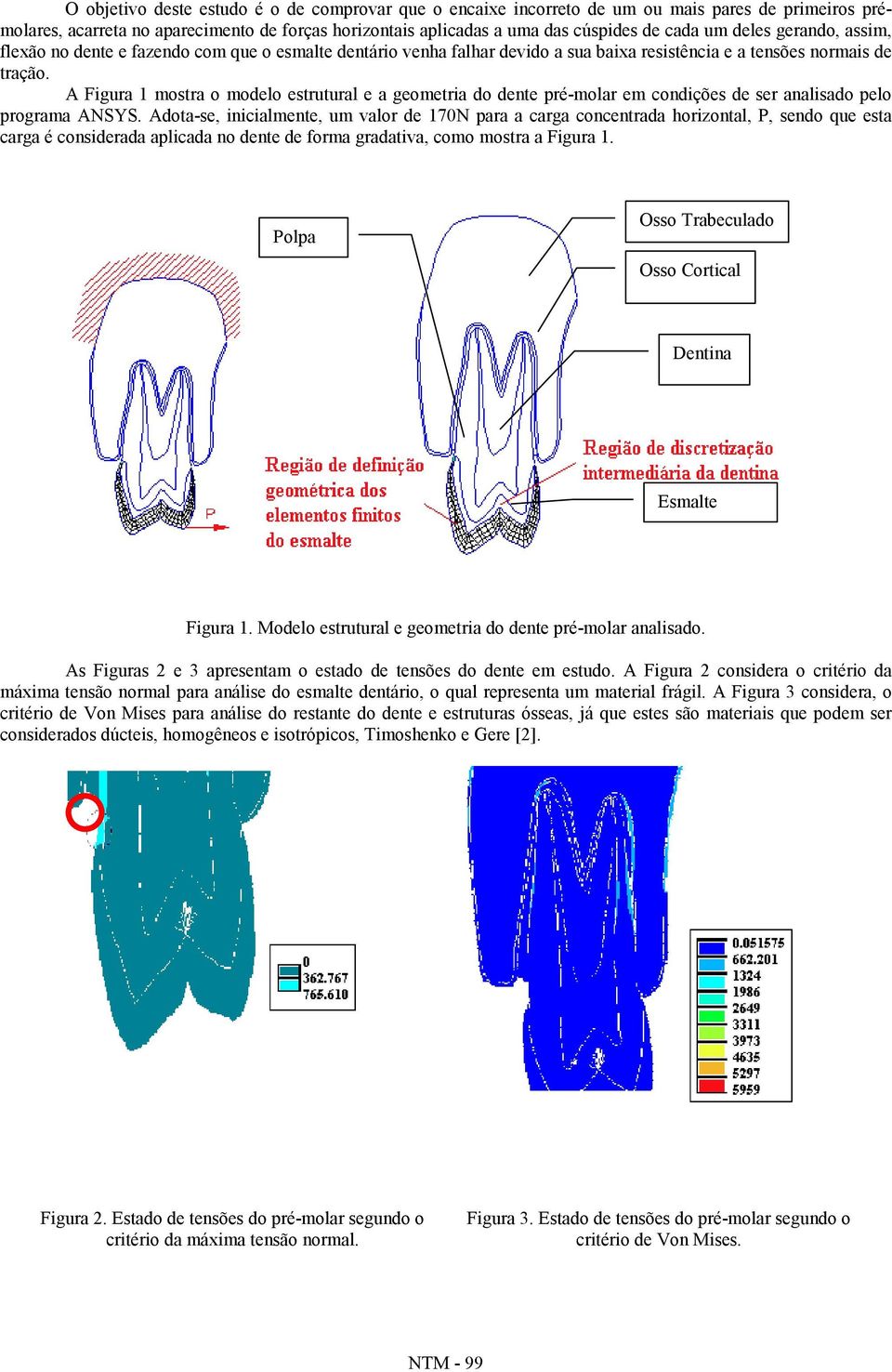 A Figura 1 mostra o modelo estrutural e a geometria do dente pré-molar em condições de ser analisado pelo programa ANSYS.