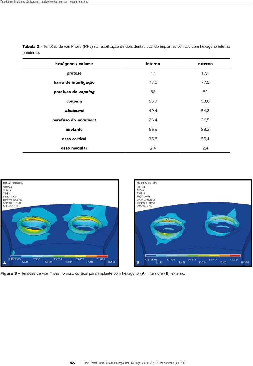 cortical 35,8 55,4 osso medular 2,4 2,4 NODAL SOLUTION STEP=1 SUB=1 TIME=1 SEQV (AVG) DMX=0,400E-08 SMN=0,198E-05 SMX=35,846 NODAL SOLUTION STEP=1 SUB=1 TIME=1 SEQV (AVG) DMX=0,400E-08 SMN=0,516E-05