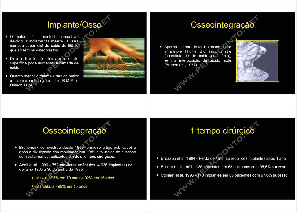 (constituídade de óxido de titânio), sem a interposição de tecido mole (Branemark, 1977). www.z-systems.de/de/html/studien.