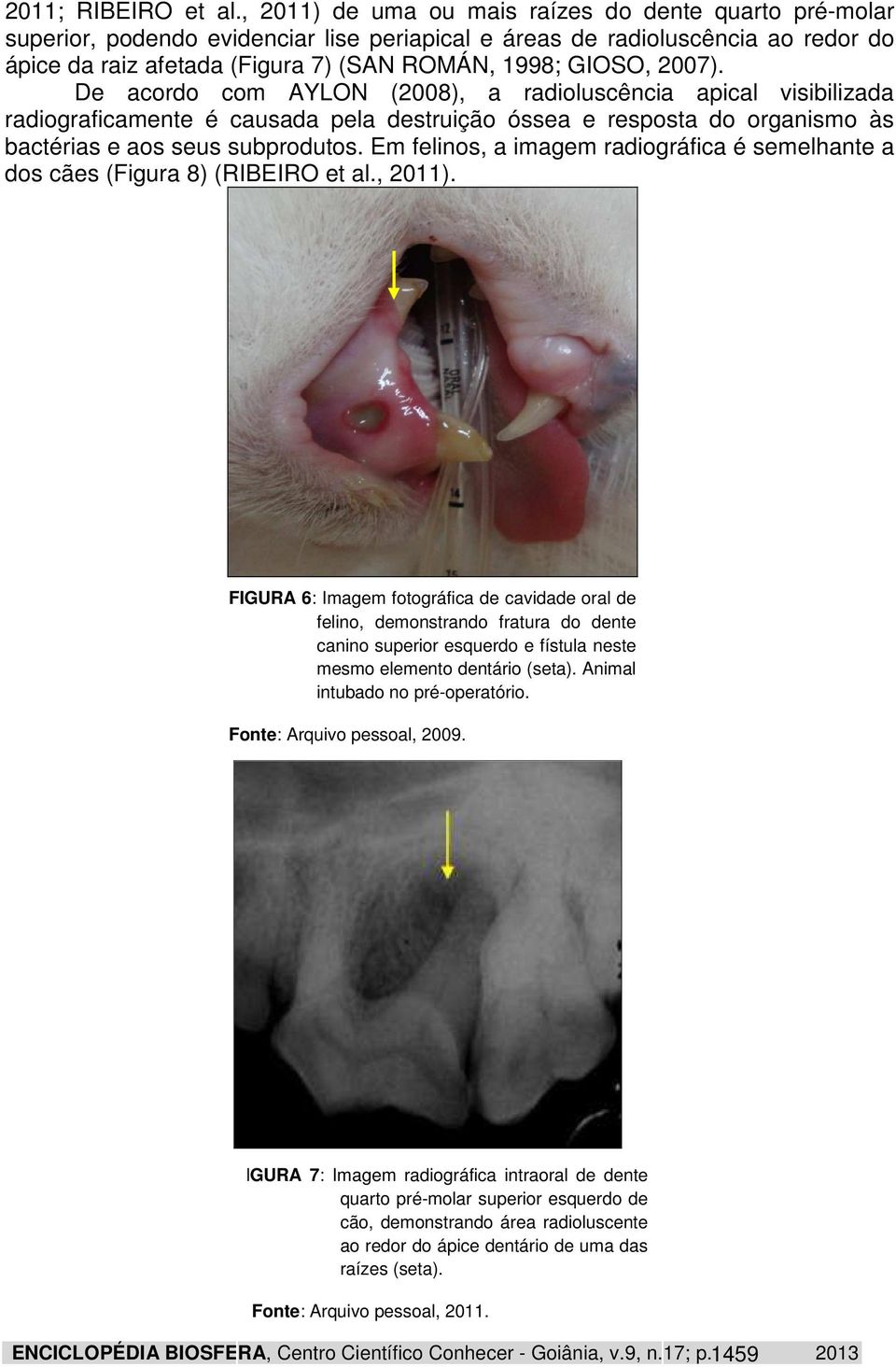 2007). De acordo com AYLON (2008), a radioluscência apical visibilizada radiograficamente é causada pela destruição óssea e resposta do organismo às bactérias e aos seus subprodutos.