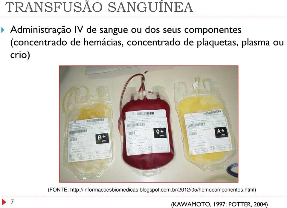 plasma ou crio) (FONTE: http://informacoesbiomedicas.blogspot.