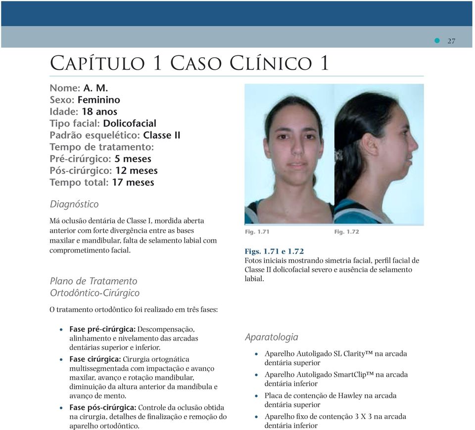 dentária de Classe I, mordida aberta anterior com forte divergência entre as bases maxilar e mandibular, falta de selamento labial com comprometimento facial.