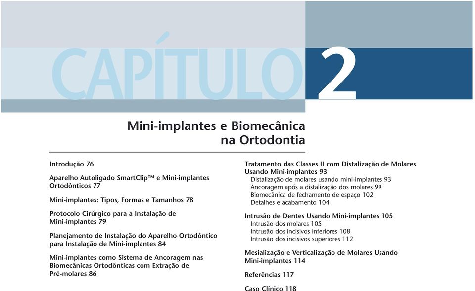 Extração de Pré-molares 86 Tratamento das Classes II com Distalização de Molares Usando Mini-implantes 93 Distalização de molares usando mini-implantes 93 Ancoragem após a distalização dos molares 99