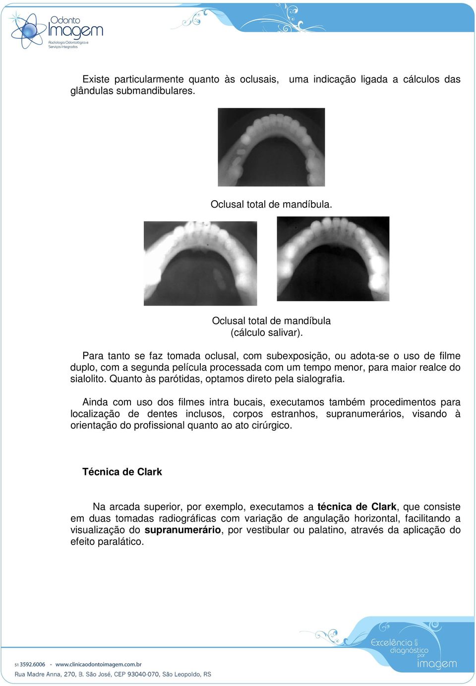 Quanto às parótidas, optamos direto pela sialografia.