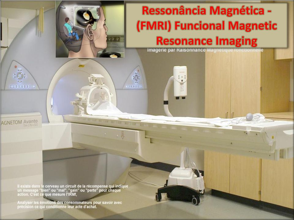 (FMRI) Funcional