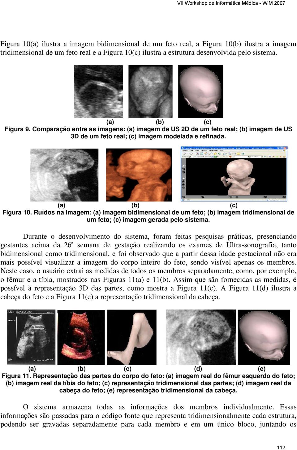 Ruídos na imagem: (a) imagem bidimensional de um feto; (b) imagem tridimensional de um feto; (c) imagem gerada pelo sistema.