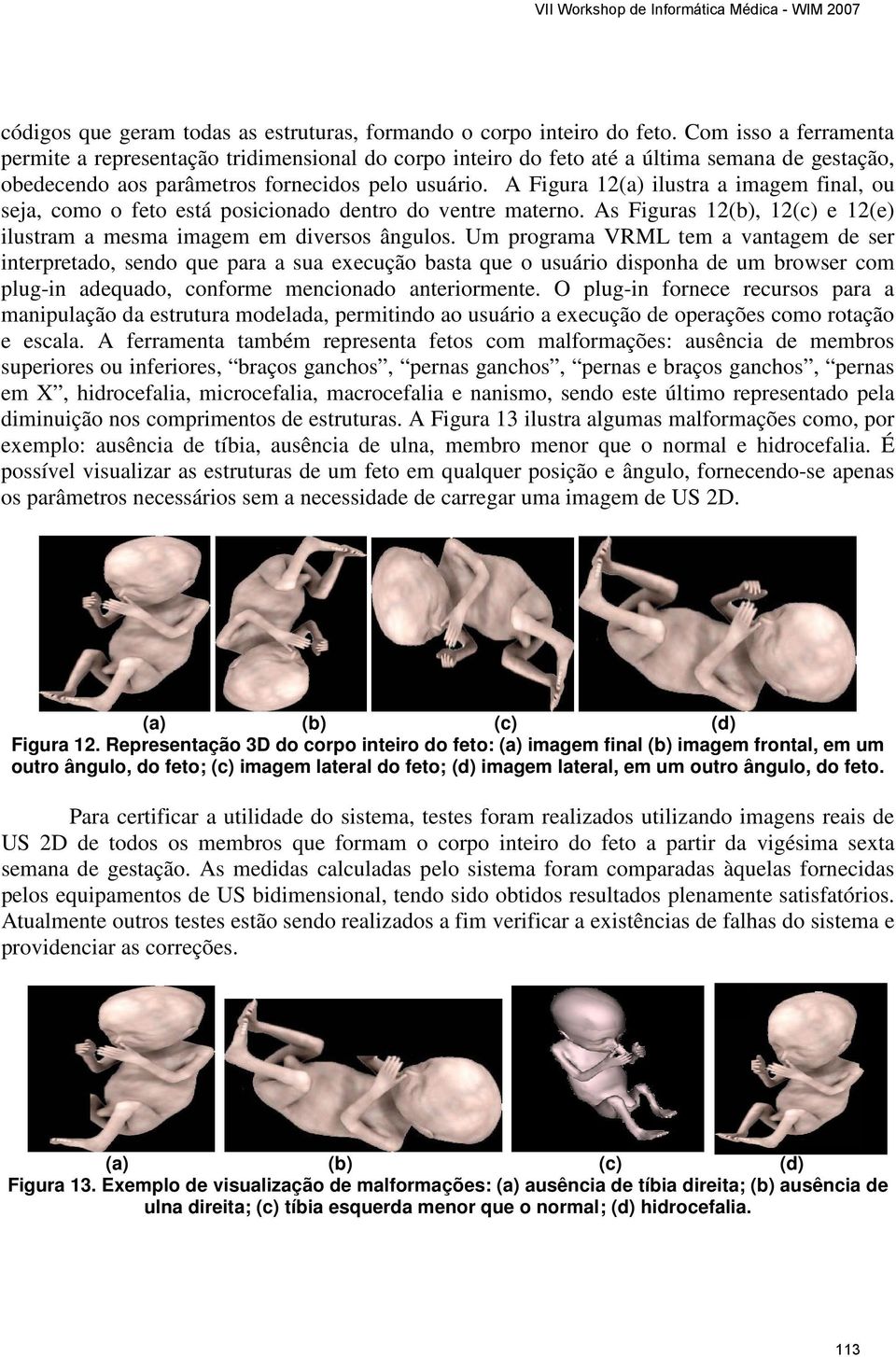 A Figura 12(a) ilustra a imagem final, ou seja, como o feto está posicionado dentro do ventre materno. As Figuras 12(b), 12(c) e 12(e) ilustram a mesma imagem em diversos ângulos.