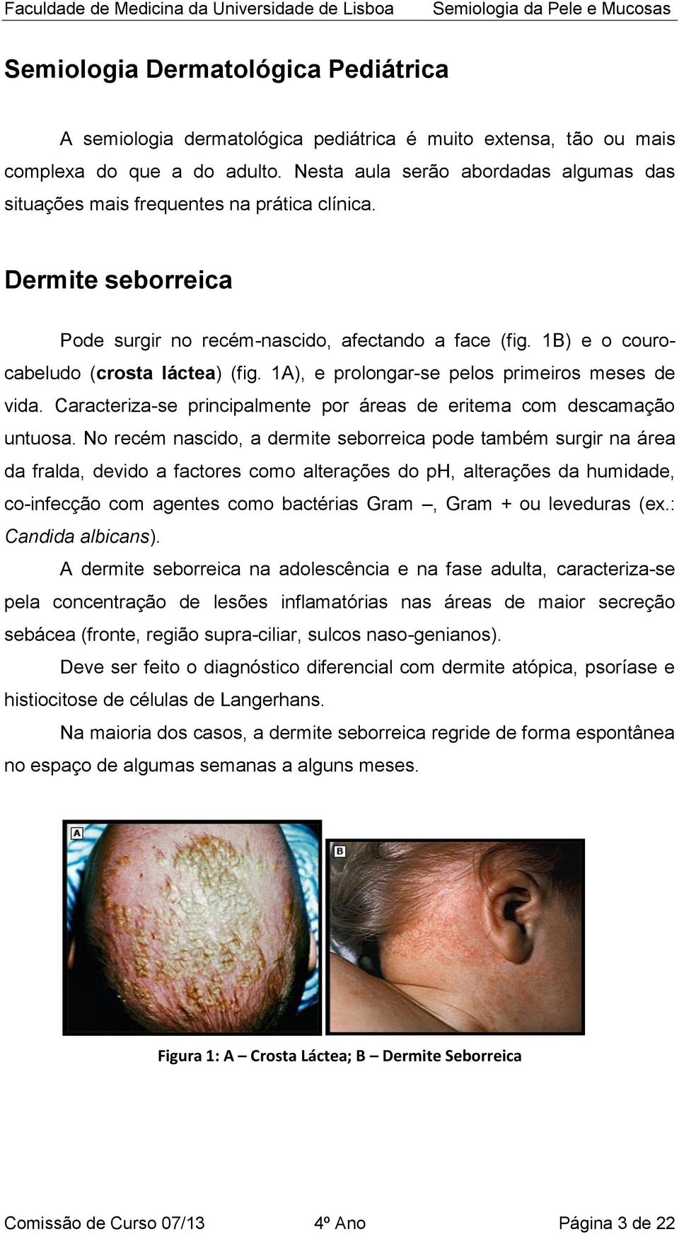 1A), e prolongar-se pelos primeiros meses de vida. Caracteriza-se principalmente por áreas de eritema com descamação untuosa.