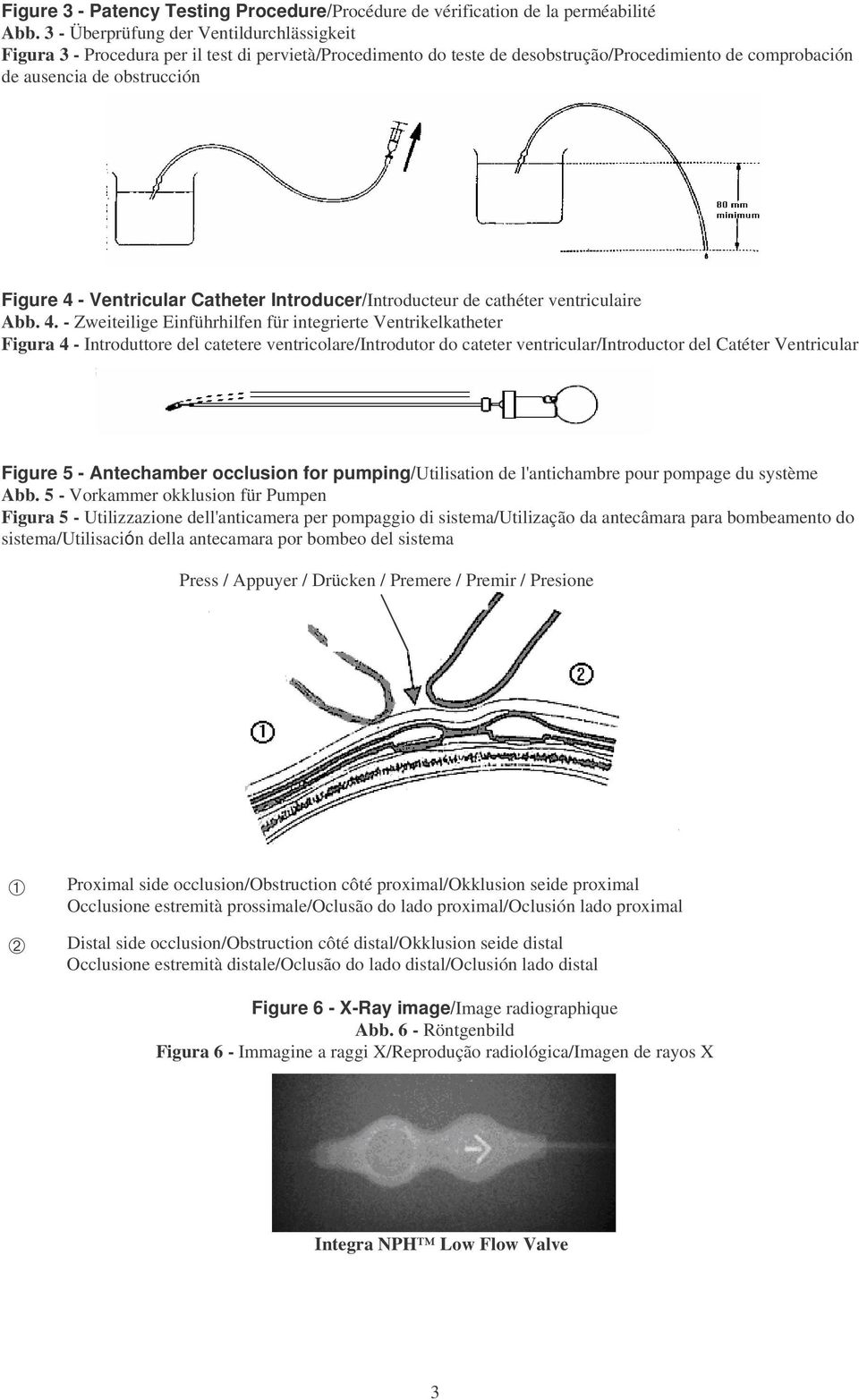 Ventricular Catheter Introducer/Introducteur de cathéter ventriculaire Abb. 4.