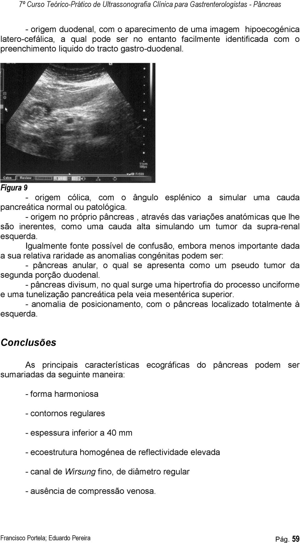 - origem no próprio pâncreas, através das variações anatómicas que lhe são inerentes, como uma cauda alta simulando um tumor da supra-renal esquerda.