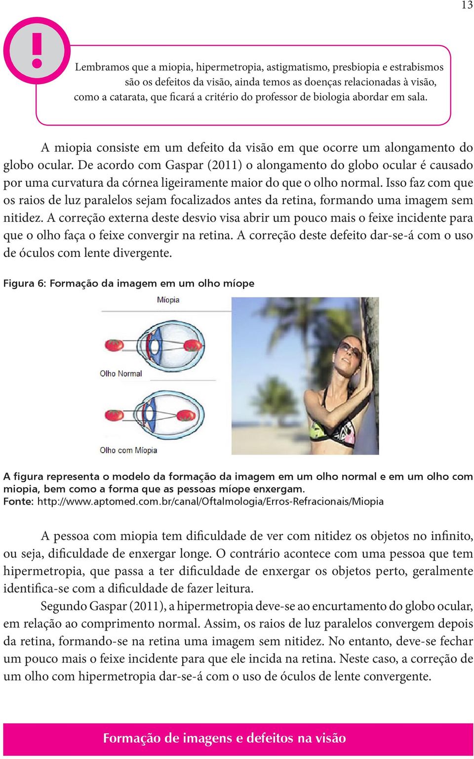 De acordo com Gaspar (2011) o alongamento do globo ocular é causado por uma curvatura da córnea ligeiramente maior do que o olho normal.