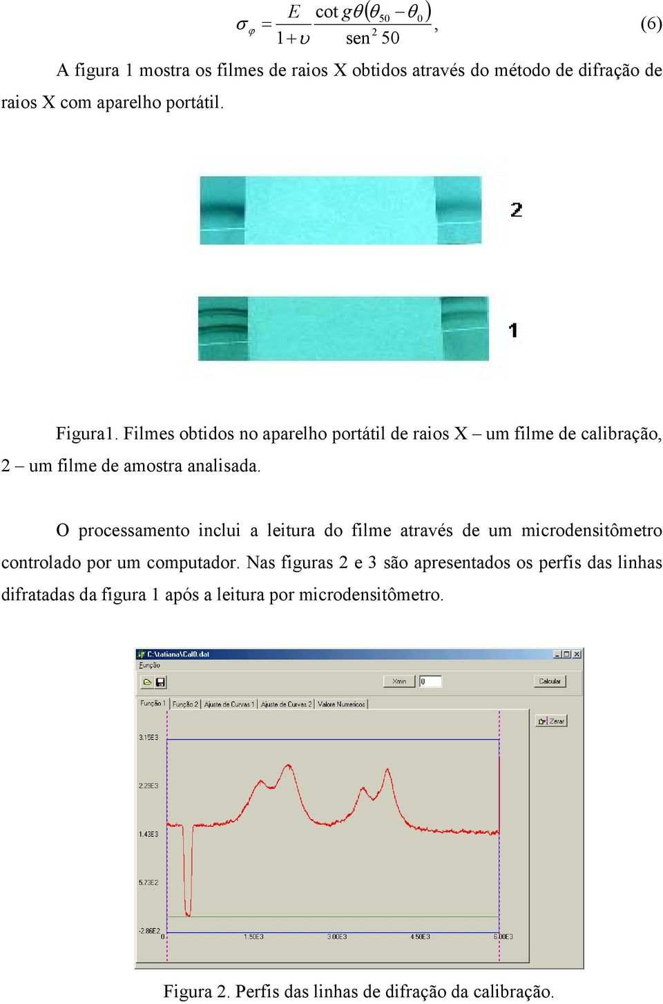 O proessamento inlui a leitura do filme através de um mirodensitômetro ontrolado por um omputador.