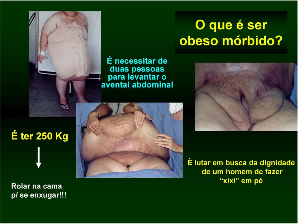 avental abdominal É ter 250 Kg Rolar na cama p/