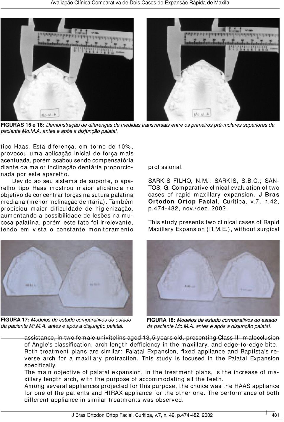 Devido ao seu sistema de suporte, o aparelho tipo Haas mostrou maior eficiência no objetivo de concentrar forças na sutura palatina mediana (menor inclinação dentária).