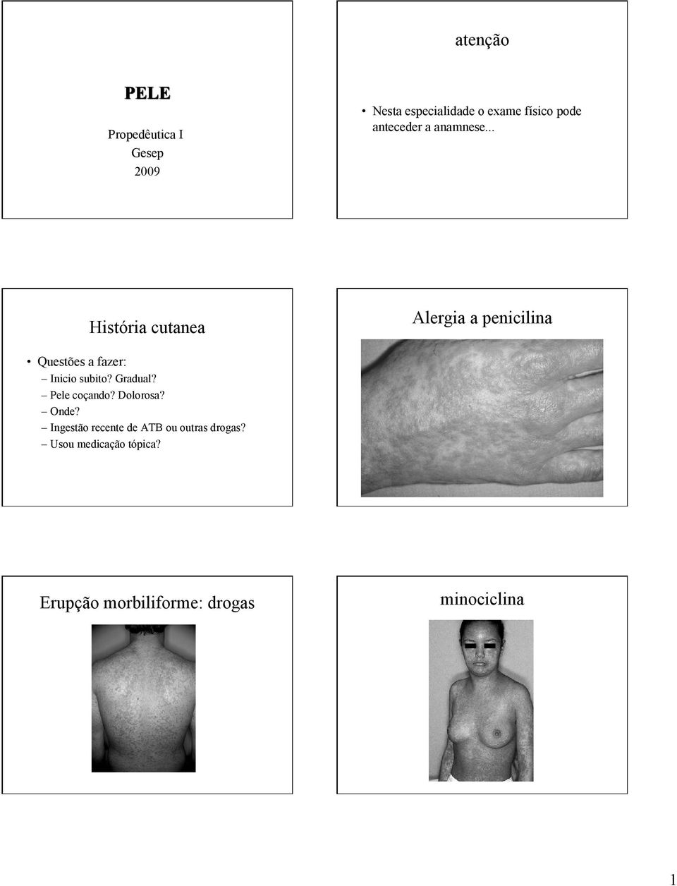 .. História cutanea Alergia a penicilina Questões a fazer: Inicio subito?