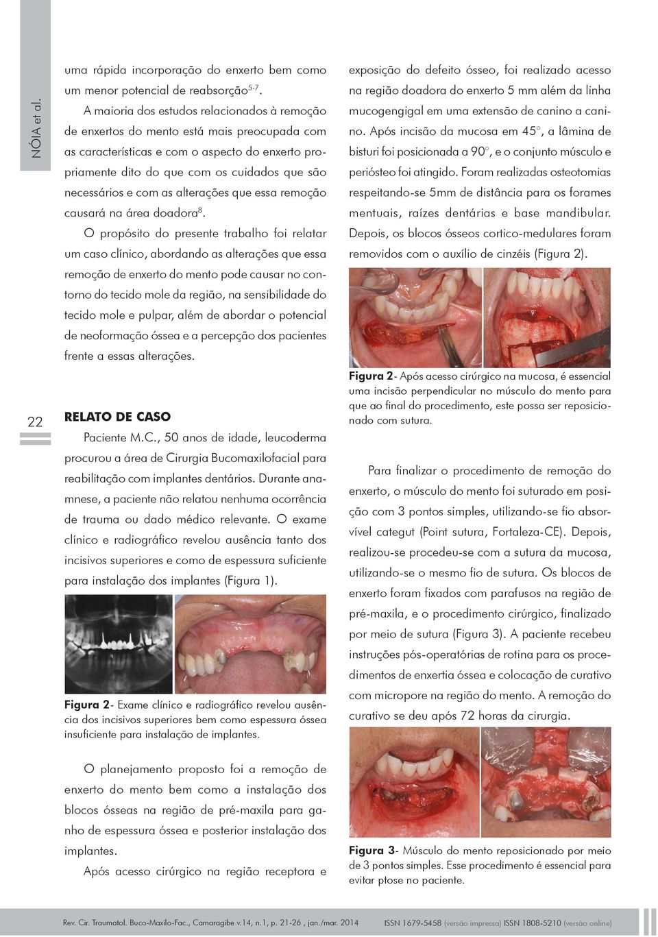 com as alterações que essa remoção causará na área doadora 8.