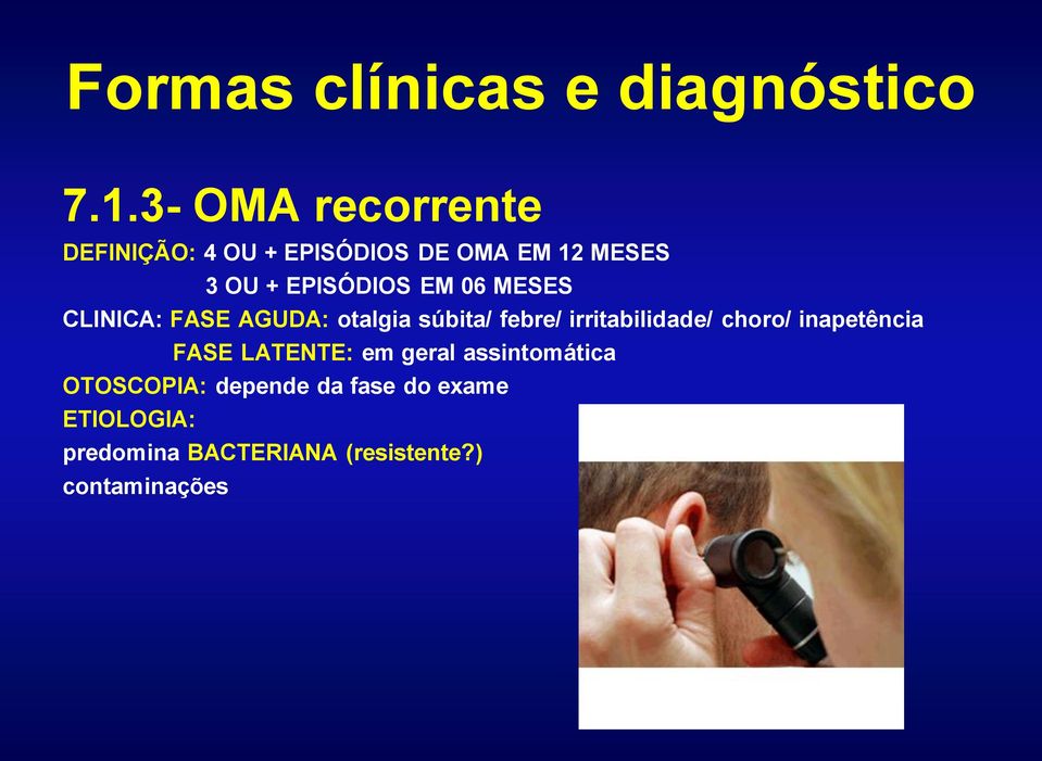 06 MESES CLINICA: FASE AGUDA: otalgia súbita/ febre/ irritabilidade/ choro/