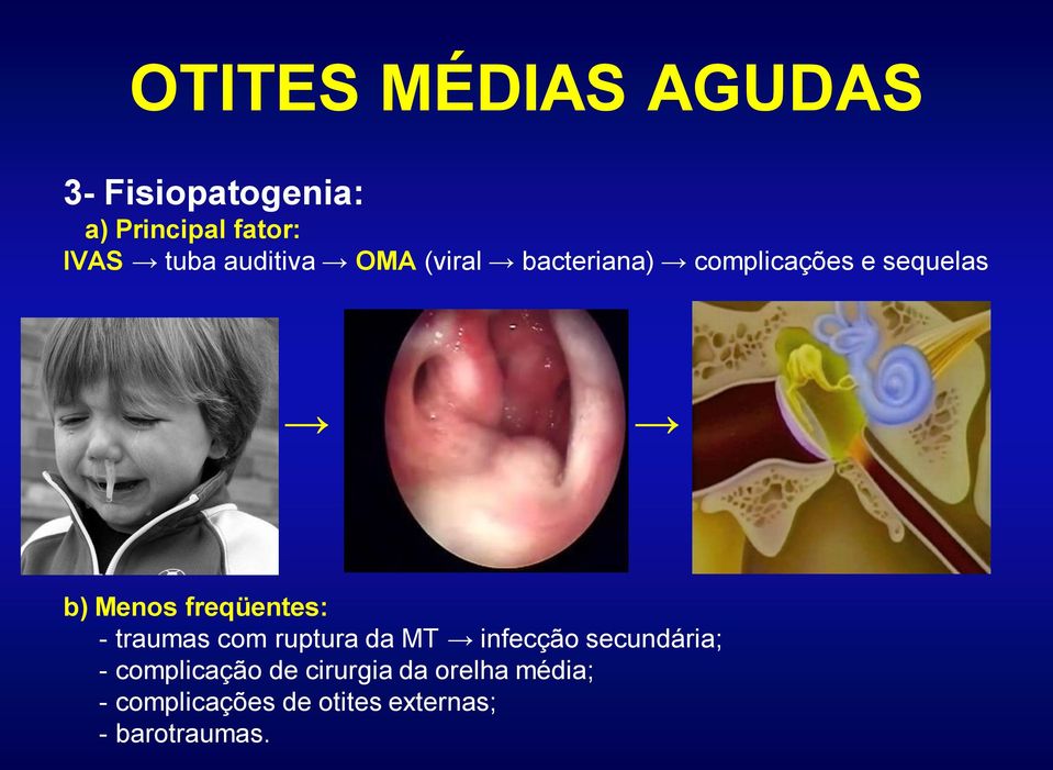 traumas com ruptura da MT infecção secundária; - complicação de