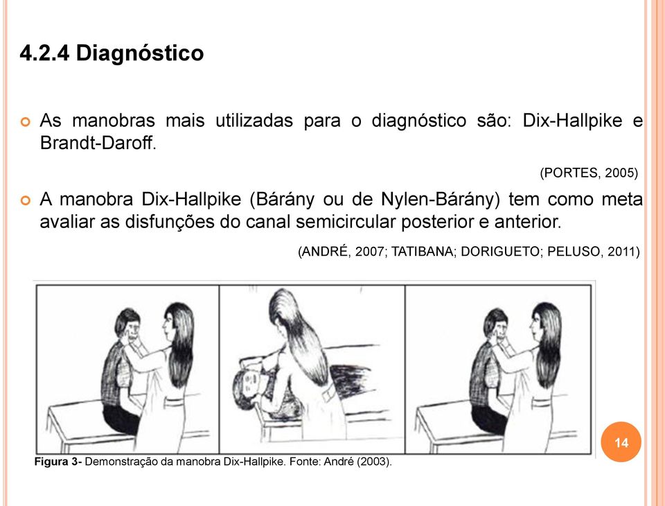 (PORTES, 2005) A manobra Dix-Hallpike (Bárány ou de Nylen-Bárány) tem como meta avaliar as