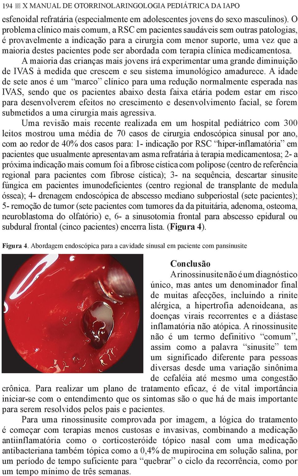 abordada com terapia clínica medicamentosa. A maioria das crianças mais jovens irá experimentar uma grande diminuição de IVAS à medida que crescem e seu sistema imunológico amadurece.