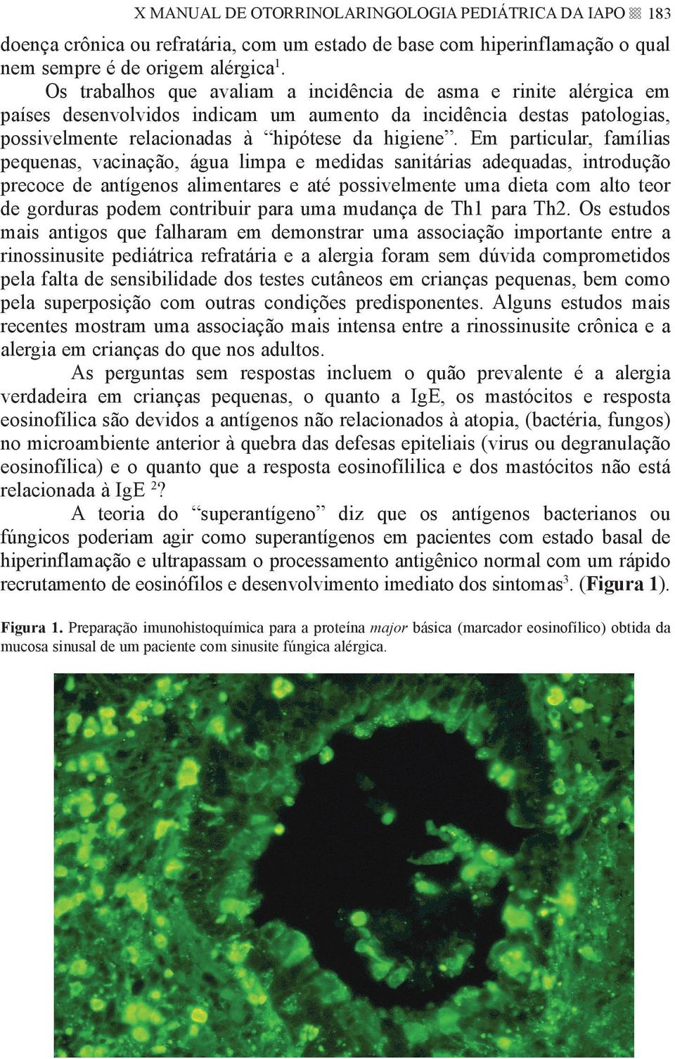 Em particular, famílias pequenas, vacinação, água limpa e medidas sanitárias adequadas, introdução precoce de antígenos alimentares e até possivelmente uma dieta com alto teor de gorduras podem