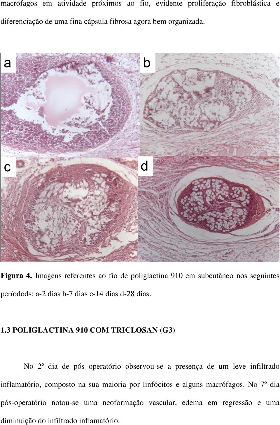 3 POLIGLACTINA 910 COM TRICLOSAN (G3) No 2º dia de pós operatório observou-se a presença de um leve infiltrado inflamatório, composto na sua maioria