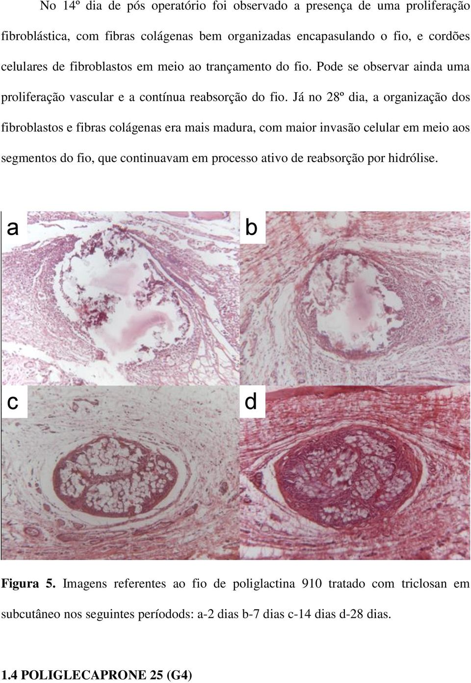 Já no 28º dia, a organização dos fibroblastos e fibras colágenas era mais madura, com maior invasão celular em meio aos segmentos do fio, que continuavam em processo ativo