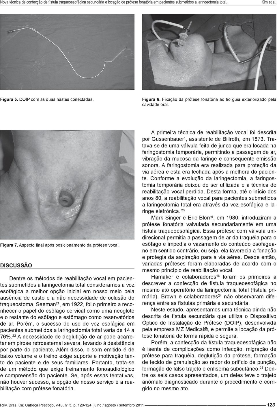 necessidade de oclusão do traqueostoma. Seeman 21, em 1922, foi o primeiro a reconhecer o papel do esôfago cervical como uma neoglote e o restante do esôfago e estômago como reservatórios de ar.