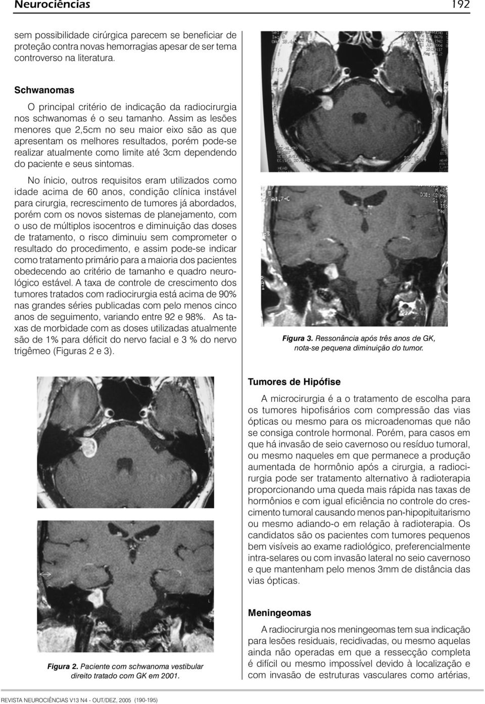 Assim as lesões menores que 2,5cm no seu maior eixo são as que apresentam os melhores resultados, porém pode-se realizar atualmente como limite até 3cm dependendo do paciente e seus sintomas.