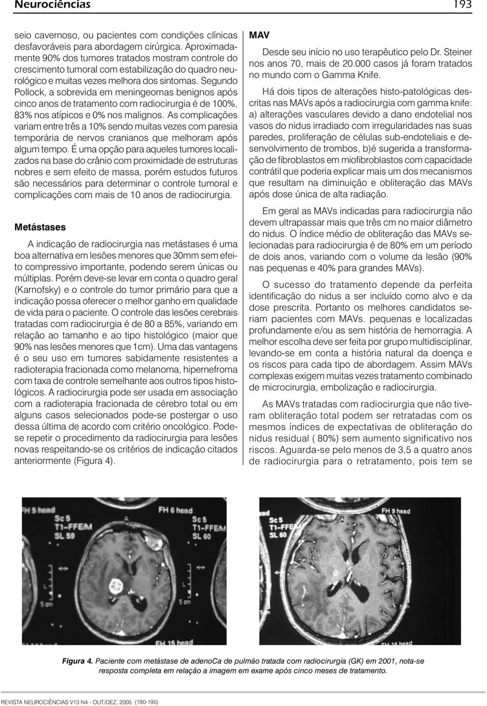 Segundo Pollock, a sobrevida em meningeomas benignos após cinco anos de tratamento com radiocirurgia é de 100%, 83% nos atípicos e 0% nos malignos.