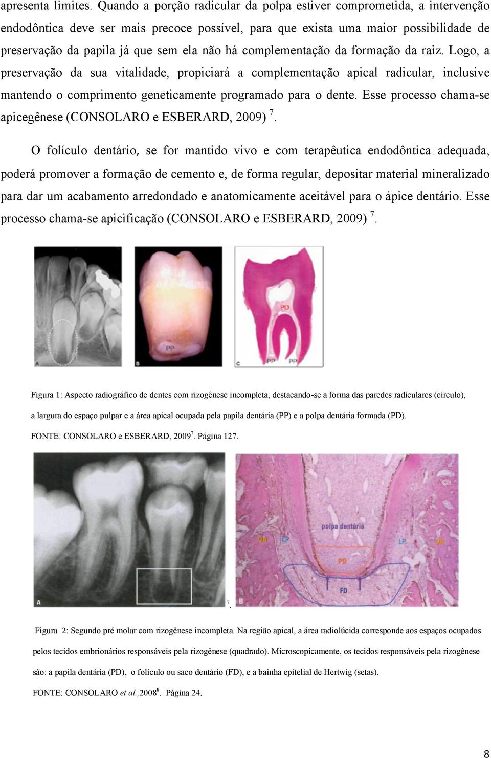 há complementação da formação da raiz. Logo, a preservação da sua vitalidade, propiciará a complementação apical radicular, inclusive mantendo o comprimento geneticamente programado para o dente.