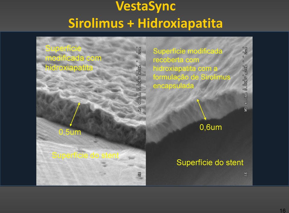 recoberta com hidroxiapatita com a formulação de